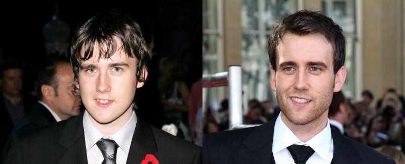 Awkward Childhood Stars Who Turned Insanely Hot